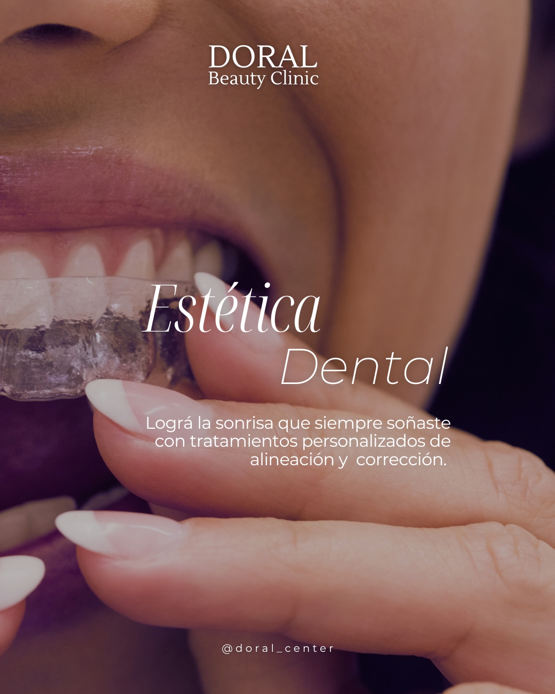 Blanqueamiento Dental